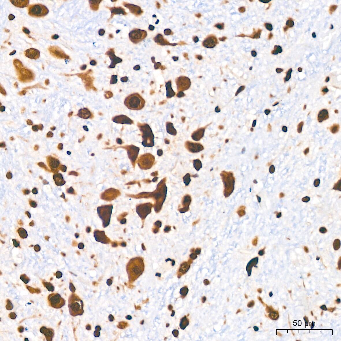 DDX5 Antibody (1K6X10)