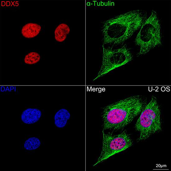 DDX5 Antibody (1K6X10)
