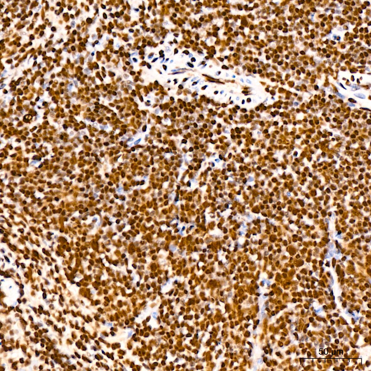 DDX5 Antibody (1K6X10)
