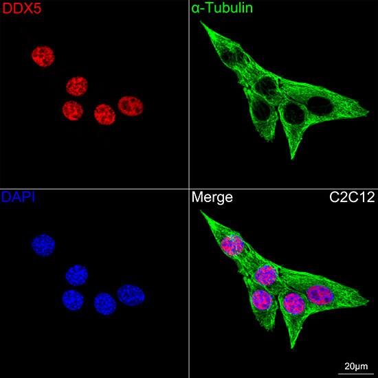 DDX5 Antibody (1K6X10)