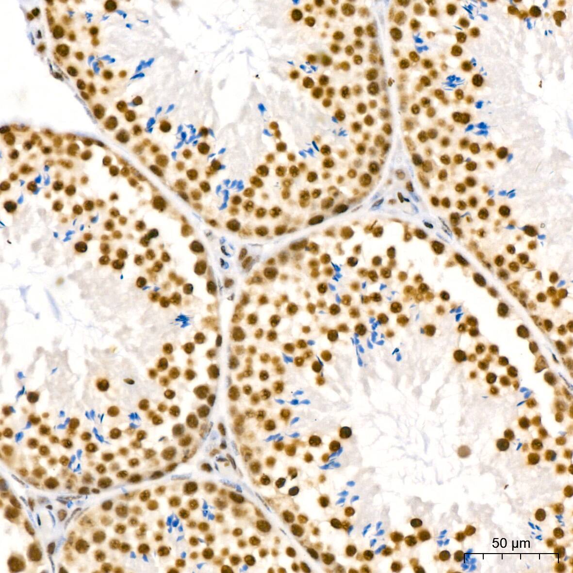 DDX5 Antibody (1K6X10)