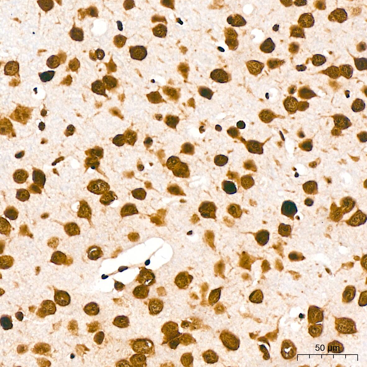 DDX5 Antibody (1K6X10)