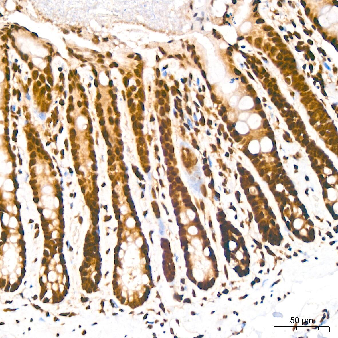 DDX5 Antibody (1K6X10)