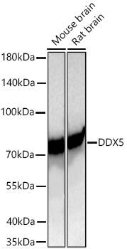 DDX5 Antibody (1K6X10)