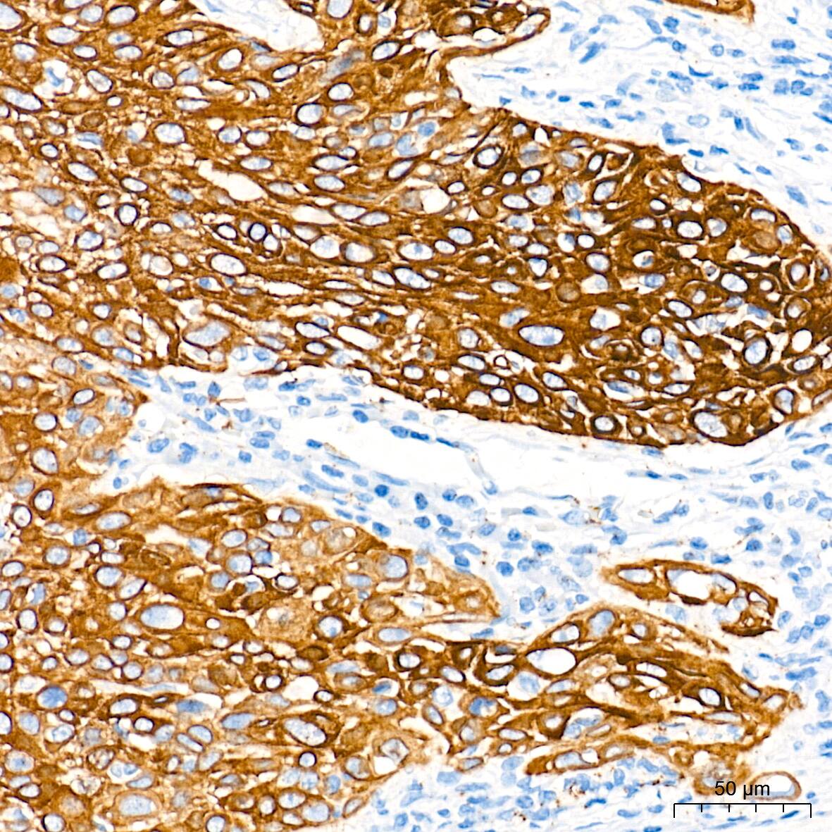 Cytokeratin 5 Antibody (3P3T9)
