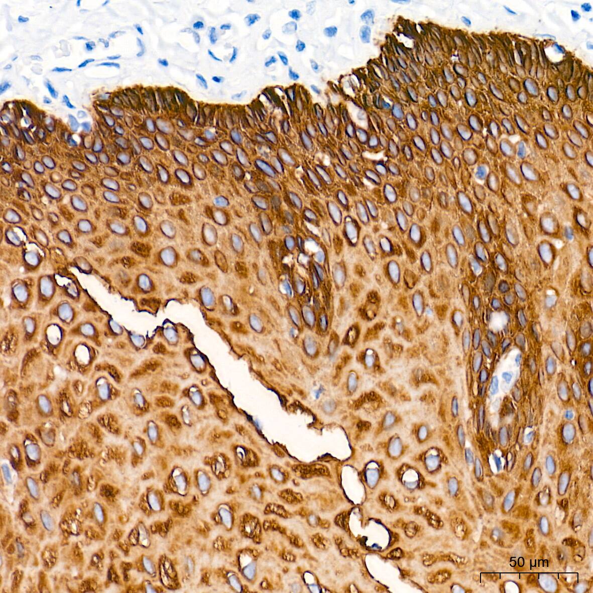 Cytokeratin 5 Antibody (3P3T9)