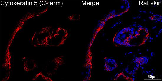 Cytokeratin 5 Antibody (3P3T9)