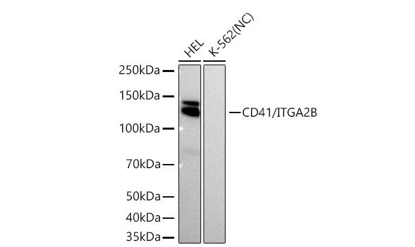 Integrin alpha 2b/CD41 Antibody (6Q5C2)