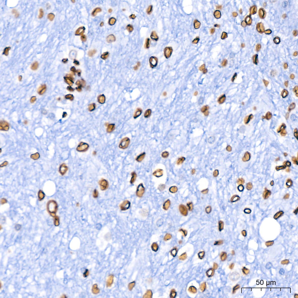 Lamin B1 Antibody (5H8V8)