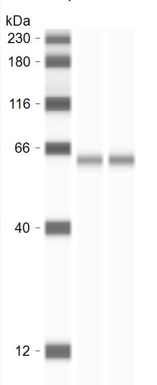 Monoamine Oxidase B Antibody (5M8A5)