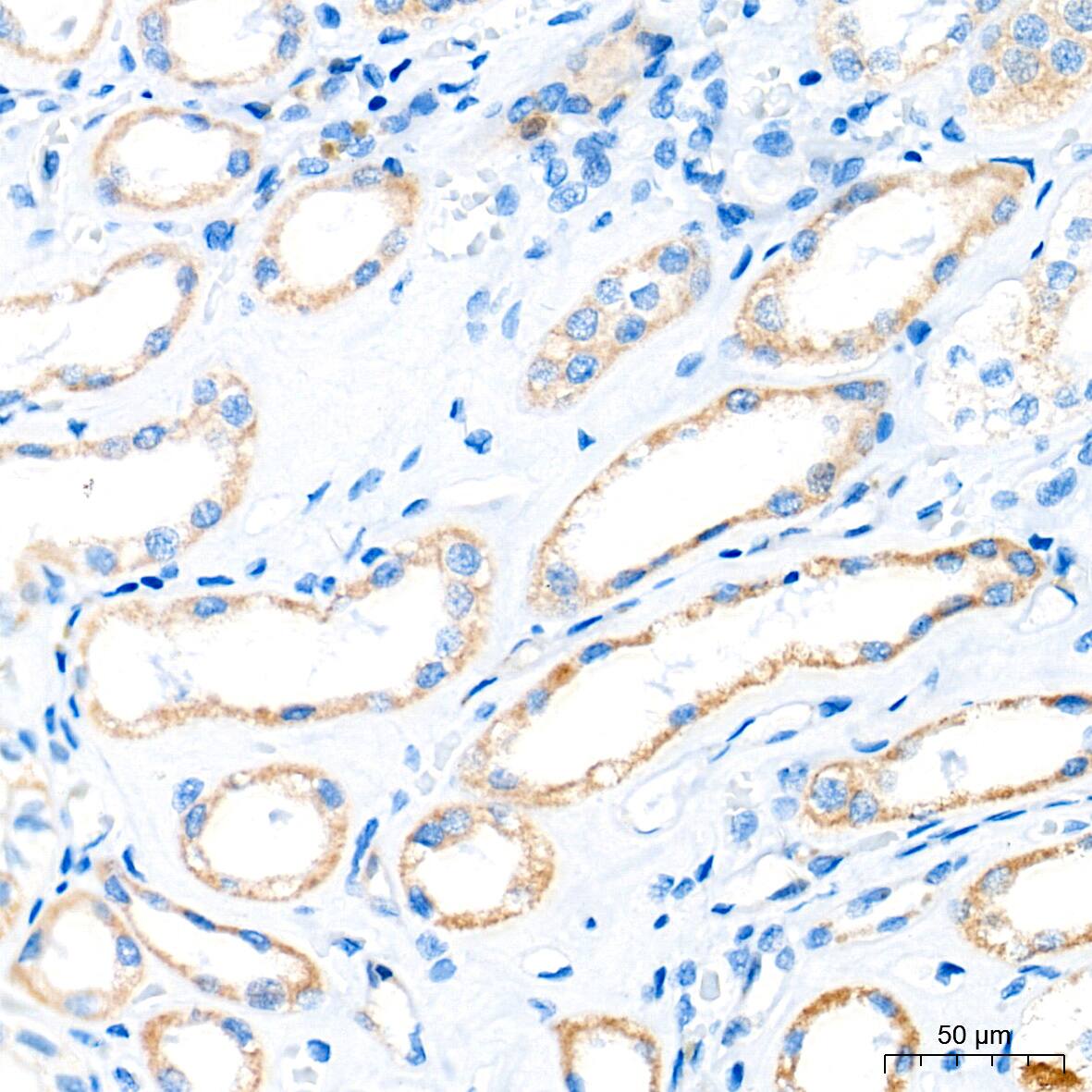 CBS Antibody (1R2E9)