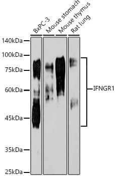 IFN-gamma R1/CD119 Antibody (2B9Q1)