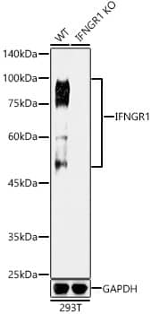IFN-gamma R1/CD119 Antibody (2B9Q1)