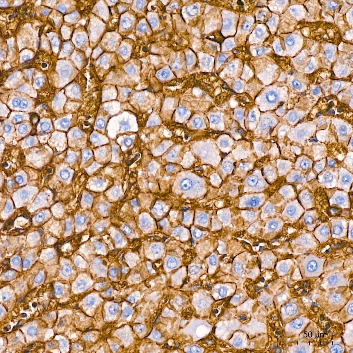 Sodium Potassium ATPase Alpha 1 Antibody (3L6F0)