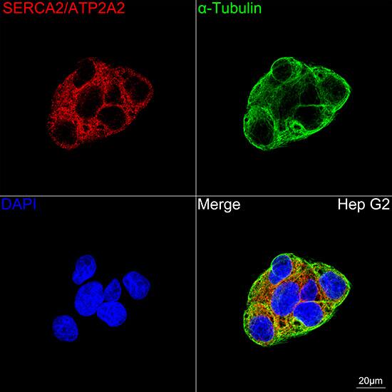 SERCA2 ATPase Antibody (10F0M9)