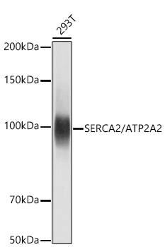 SERCA2 ATPase Antibody (10F0M9)