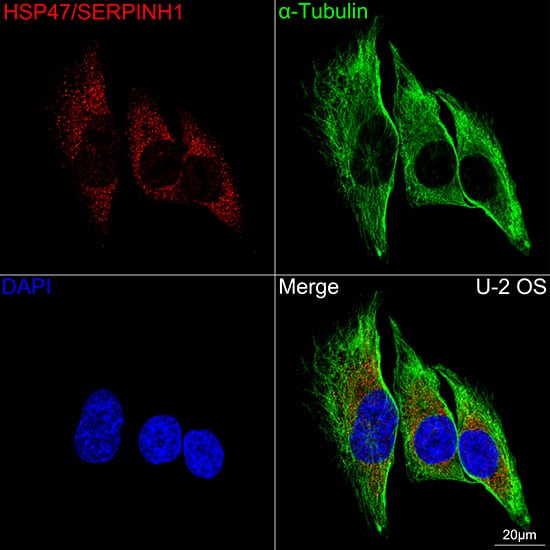 Hsp47 Antibody (3K3H1)