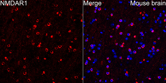 NMDAR1 Antibody (1H1T3)