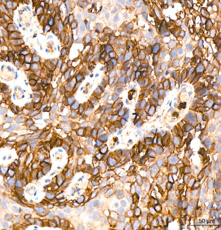 Glut1 Antibody (10O1I5)