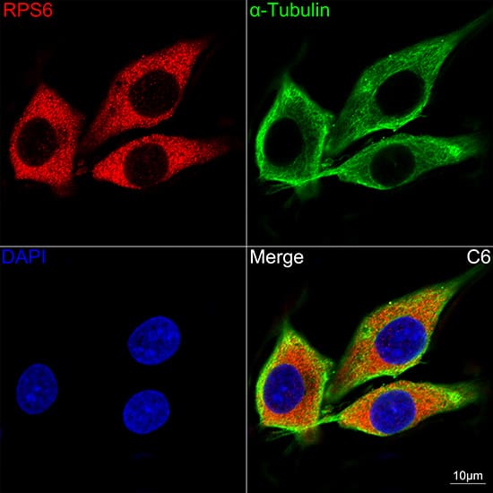 Ribosomal Protein S6/RPS6 Antibody (4C7P4)