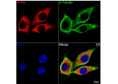 Ribosomal Protein S6/RPS6 Antibody (4C7P4)