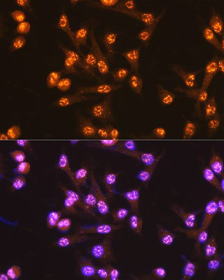 CDC25C Antibody (6R0I6)