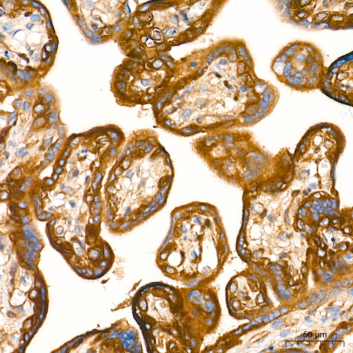 Aromatase Antibody (5C5N7)