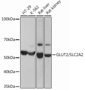 Glut2 Antibody (2V2U2)