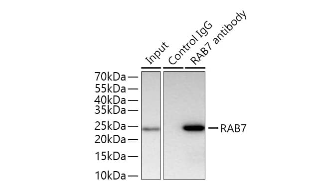 Rab7a Antibody (5A10A4)