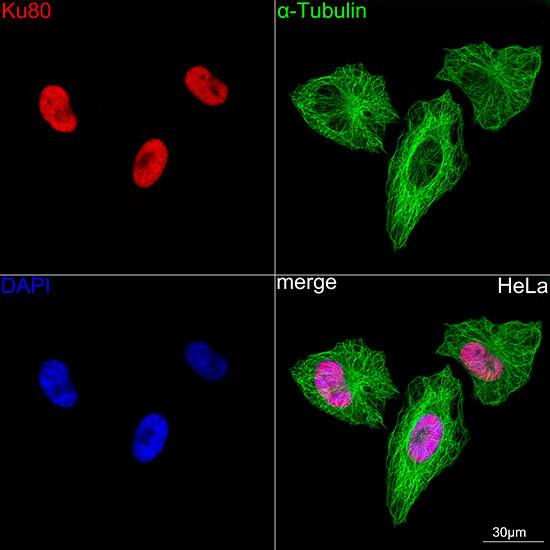 Ku80/XRCC5 Antibody (7N7G3)