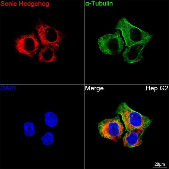 Sonic Hedgehog/Shh Antibody (8T4D3)