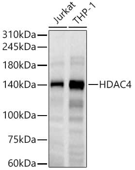 Histone Deacetylase 4/HDAC4 Antibody (9A6E2)