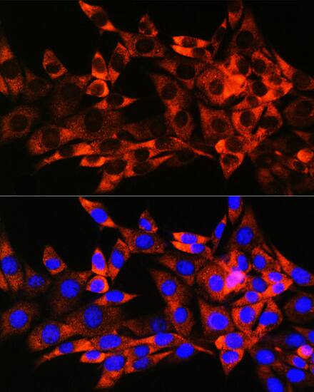 HSPB8/HSP22 Antibody (3K10W1)