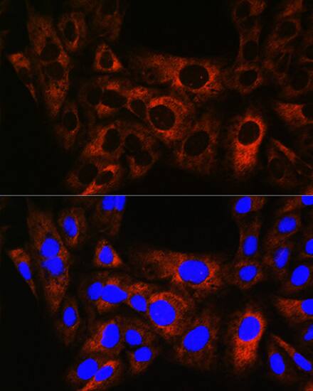 HSPB8/HSP22 Antibody (3K10W1)