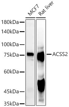Acetyl CoA synthetase Antibody - BSA Free