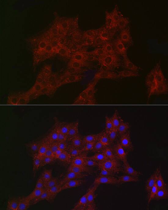 ARPC2 Antibody (4F2G6)