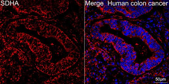SDHA Antibody (0Y8X5)