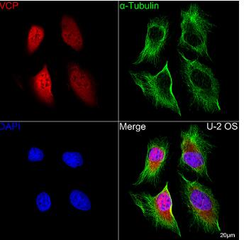p97/VCP Antibody (3P8T3)