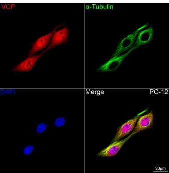p97/VCP Antibody (3P8T3)