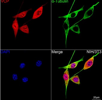 p97/VCP Antibody (3P8T3)