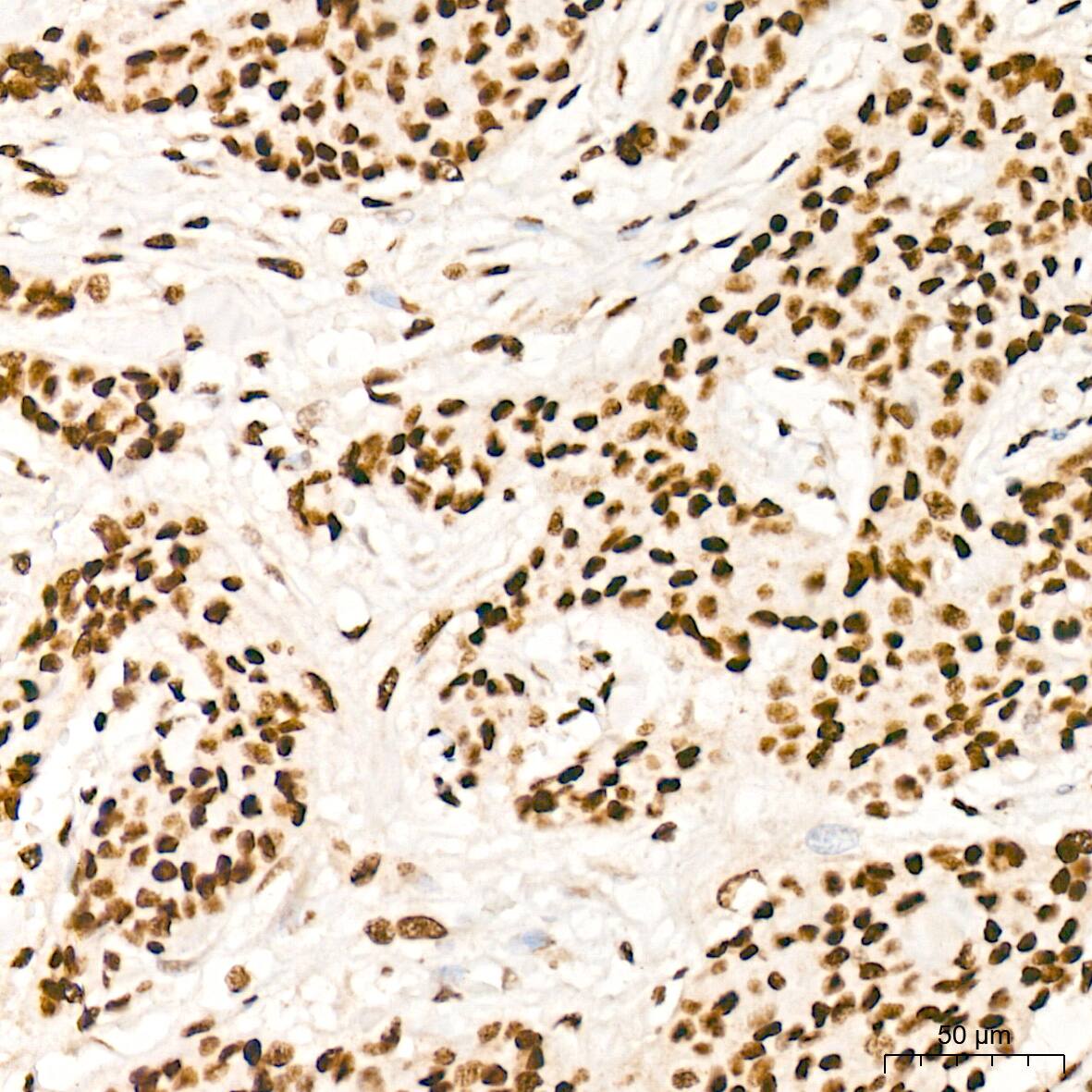 PDCD7 Antibody (8A1Q3)