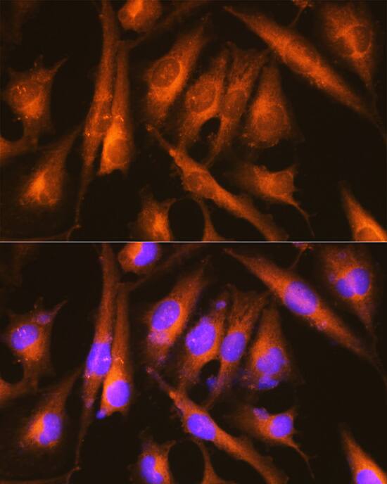Huntingtin Antibody - Azide and BSA Free
