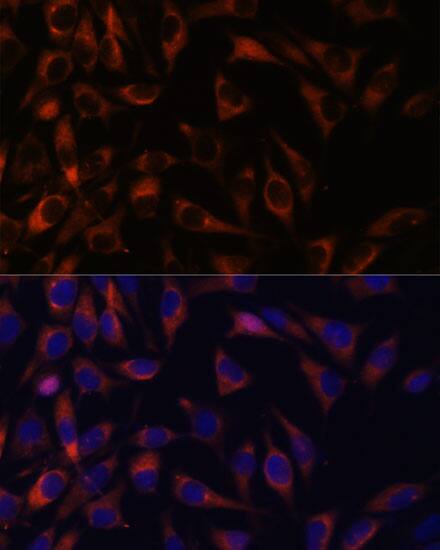 WFDC1 Antibody - Azide and BSA Free