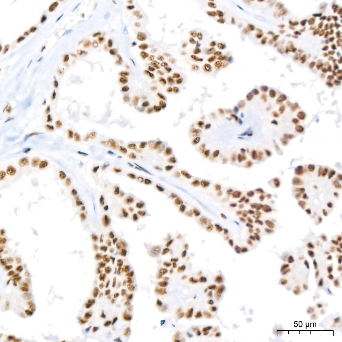 PABPN1 Antibody (7V4X8)