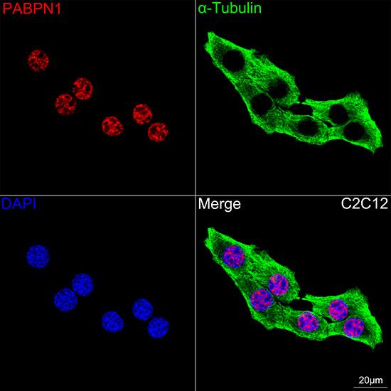 PABPN1 Antibody (7V4X8)