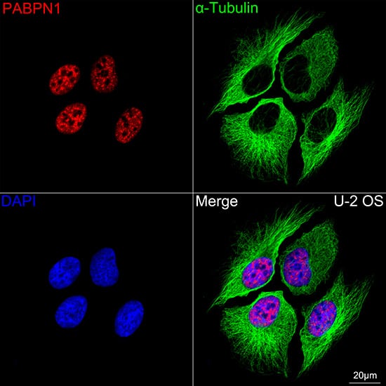 PABPN1 Antibody (7V4X8)