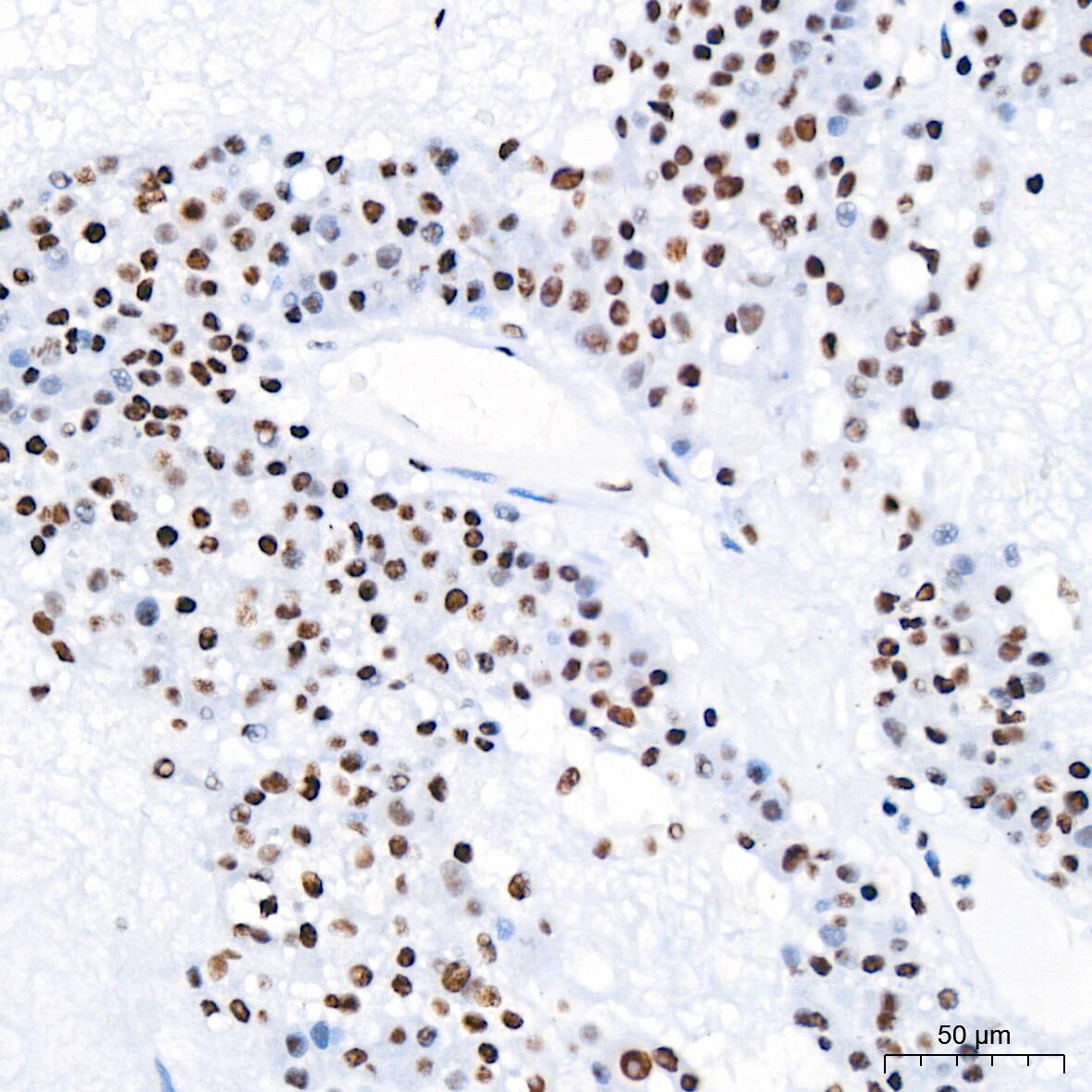 PABPN1 Antibody (7V4X8)