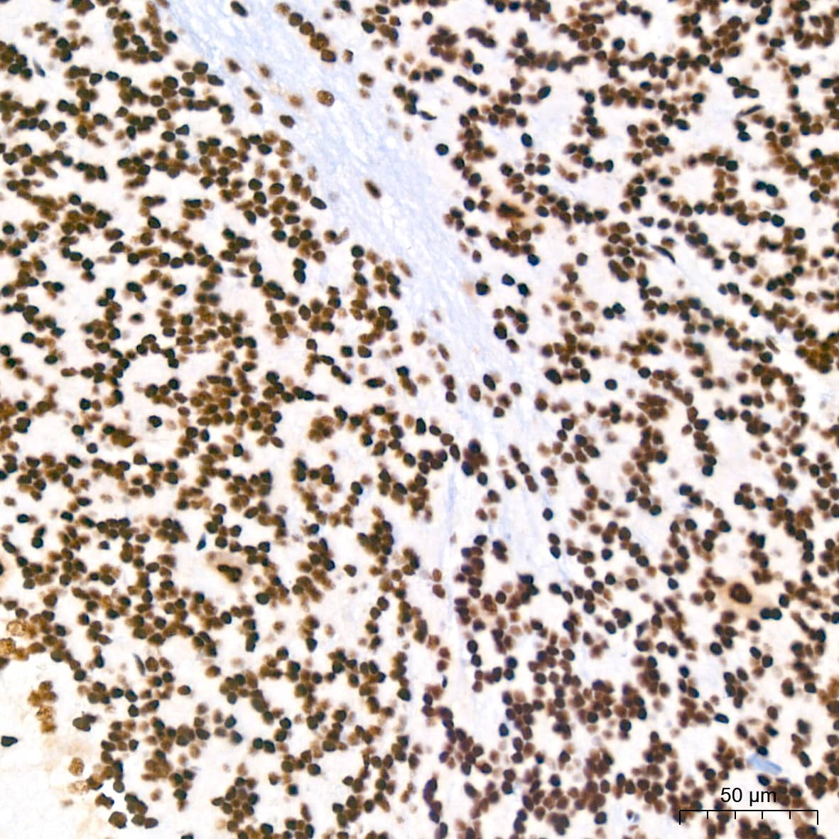 PABPN1 Antibody (7V4X8)
