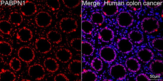 PABPN1 Antibody (7V4X8)