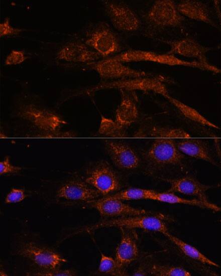 AP3S2 Antibody - Azide and BSA Free